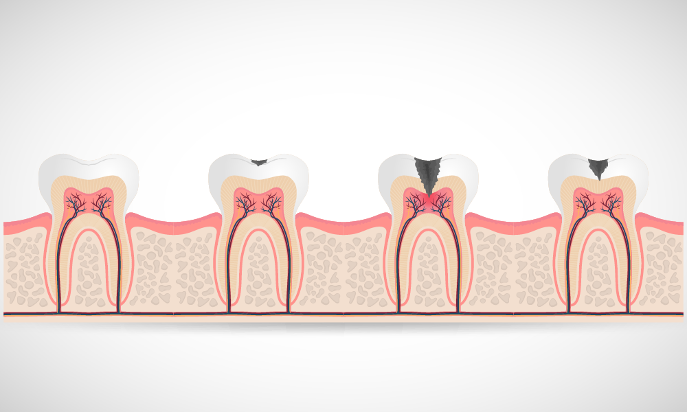 treatmentImageAlt.alt